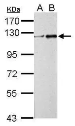 Anti-ZNF711 antibody used in Western Blot (WB). GTX120140