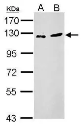Anti-ZNF711 antibody used in Western Blot (WB). GTX120140