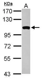 Anti-GCC1 antibody [C1C3] used in Western Blot (WB). GTX120148