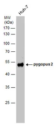Anti-Pygopus 2 antibody used in Western Blot (WB). GTX120215