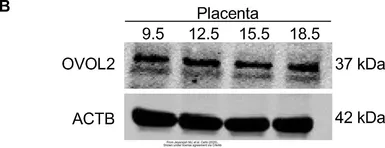 Anti-OVOL2 antibody used in Western Blot (WB). GTX120220