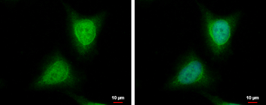 Anti-WDYHV1 antibody used in Immunocytochemistry/ Immunofluorescence (ICC/IF). GTX120298