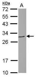 Anti-PGLS antibody used in Western Blot (WB). GTX120327