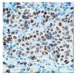 Anti-MITF antibody [C5] used in IHC (Paraffin sections) (IHC-P). GTX12039
