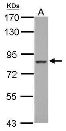 Anti-FCHO2 antibody [N1N2], N-term used in Western Blot (WB). GTX120444