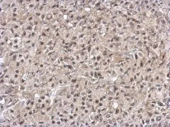 Anti-PELO antibody used in IHC (Paraffin sections) (IHC-P). GTX120446