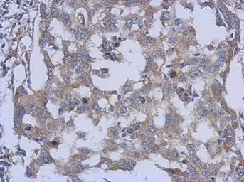 Anti-PARS2 antibody [C1C3] used in IHC (Paraffin sections) (IHC-P). GTX120510