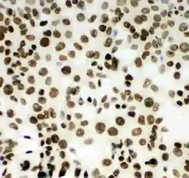 Anti-MCM2 antibody used in Immunocytochemistry/ Immunofluorescence (ICC/IF). GTX12059
