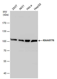 Anti-KIAA0776 antibody used in Western Blot (WB). GTX120661