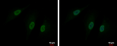 Anti-DBF4B antibody used in Immunocytochemistry/ Immunofluorescence (ICC/IF). GTX120796