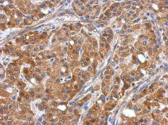 Anti-ERLIN1 antibody used in IHC (Paraffin sections) (IHC-P). GTX120815