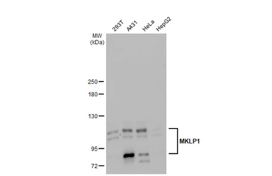 Anti-MKLP1 antibody [N1N2], N-term used in Western Blot (WB). GTX120875