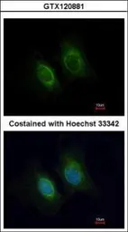 Anti-Keratin 36 antibody used in Immunocytochemistry/ Immunofluorescence (ICC/IF). GTX120881