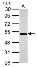 Anti-Keratin 36 antibody used in Western Blot (WB). GTX120881