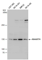 Anti-MTUS2 antibody used in Western Blot (WB). GTX120919