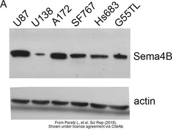 Anti-SEMA4B antibody used in Western Blot (WB). GTX121035