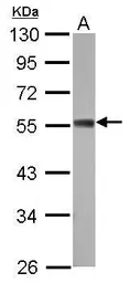 Anti-ZC3H10 antibody [N1C1] used in Western Blot (WB). GTX121156