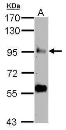 Anti-COG3 antibody [N1N2], N-term used in Western Blot (WB). GTX121212