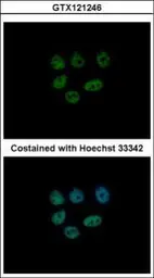 Anti-KDM6A antibody [N2C1], Internal used in Immunocytochemistry/ Immunofluorescence (ICC/IF). GTX121246