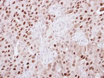 Anti-KDM6A antibody [N2C1], Internal used in IHC (Paraffin sections) (IHC-P). GTX121246