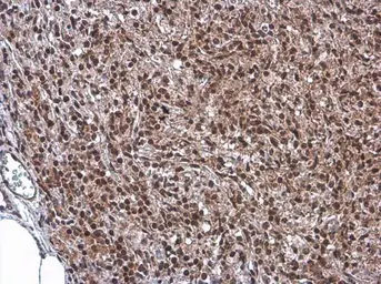 Anti-KDM6A antibody [N2C1], Internal used in IHC (Paraffin sections) (IHC-P). GTX121246