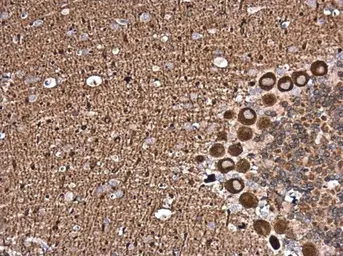 Anti-NCALD antibody used in IHC (Paraffin sections) (IHC-P). GTX121264