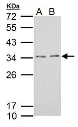 Anti-TPRG1L antibody used in Western Blot (WB). GTX121336