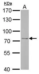 Anti-FBXO21 antibody used in Western Blot (WB). GTX121415