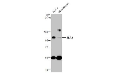 Anti-ELP2 antibody [N3C2], Internal used in Western Blot (WB). GTX121449