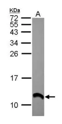 Anti-S100 alpha 2 antibody [N1C3] used in Western Blot (WB). GTX121457