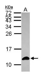 Anti-S100A6 antibody used in Western Blot (WB). GTX121460