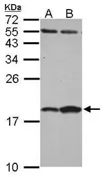 Anti-FABP7 antibody [N1C3] used in Western Blot (WB). GTX121467