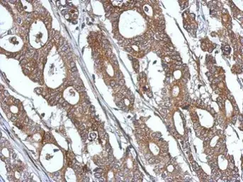 Anti-ISG15 antibody used in IHC (Paraffin sections) (IHC-P). GTX121474