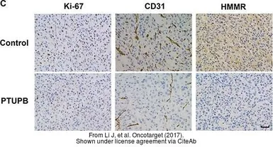 Anti-CD168 / RHAMM antibody [N1N2], N-term used in Immunohistochemistry (IHC). GTX121502