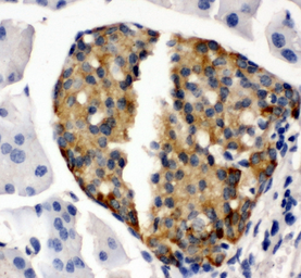 Anti-Bone Sialoprotein antibody used in IHC (Paraffin sections) (IHC-P). GTX12155