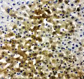 Anti-Bone Sialoprotein antibody used in IHC (Paraffin sections) (IHC-P). GTX12155