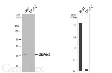 Anti-ZNF649 antibody used in Western Blot (WB). GTX121655