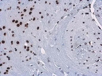 Anti-Histone H3K9me3 (Tri-methyl Lys9) antibody used in IHC (Paraffin sections) (IHC-P). GTX121677