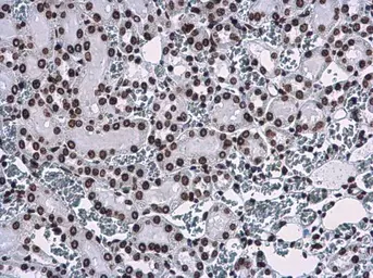 Anti-Histone H3K9me3 (Tri-methyl Lys9) antibody used in IHC (Paraffin sections) (IHC-P). GTX121677