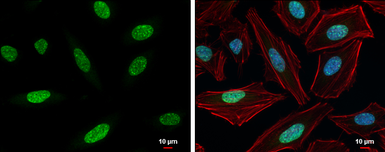 Anti-Histone H3K9me3 (Tri-methyl Lys9) antibody used in Immunocytochemistry/ Immunofluorescence (ICC/IF). GTX121677