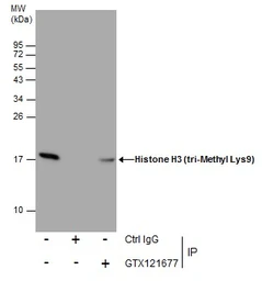 Anti-Histone H3K9me3 (Tri-methyl Lys9) antibody used in Immunoprecipitation (IP). GTX121677
