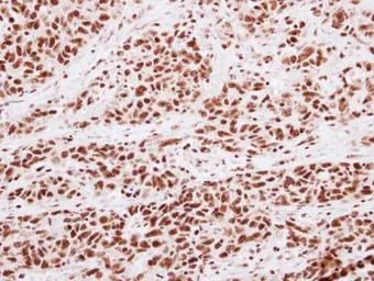 Anti-Histone H3K4me2 (Di-methyl Lys4) antibody used in IHC (Paraffin sections) (IHC-P). GTX121915