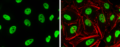 Anti-Histone H3K4me2 (Di-methyl Lys4) antibody used in Immunocytochemistry/ Immunofluorescence (ICC/IF). GTX121915