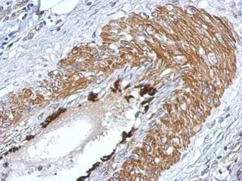 Anti-Lin28A antibody used in IHC (Paraffin sections) (IHC-P). GTX121923