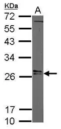 Anti-Lin28A antibody used in Western Blot (WB). GTX121923