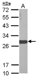 Anti-Lin28A antibody used in Western Blot (WB). GTX121923