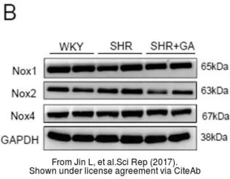 Anti-NOX4 antibody [N3C3] used in Western Blot (WB). GTX121929