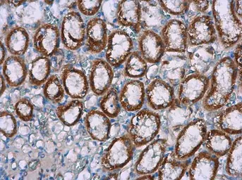 Anti-NOX4 antibody [N3C3] used in IHC (Paraffin sections) (IHC-P). GTX121929
