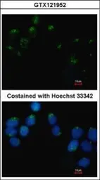 Anti-EMB antibody [N3C3] used in Immunocytochemistry/ Immunofluorescence (ICC/IF). GTX121952
