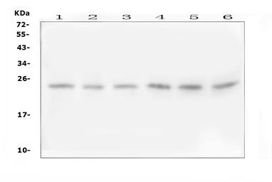 Anti-FSTL3 antibody used in Western Blot (WB). GTX12198